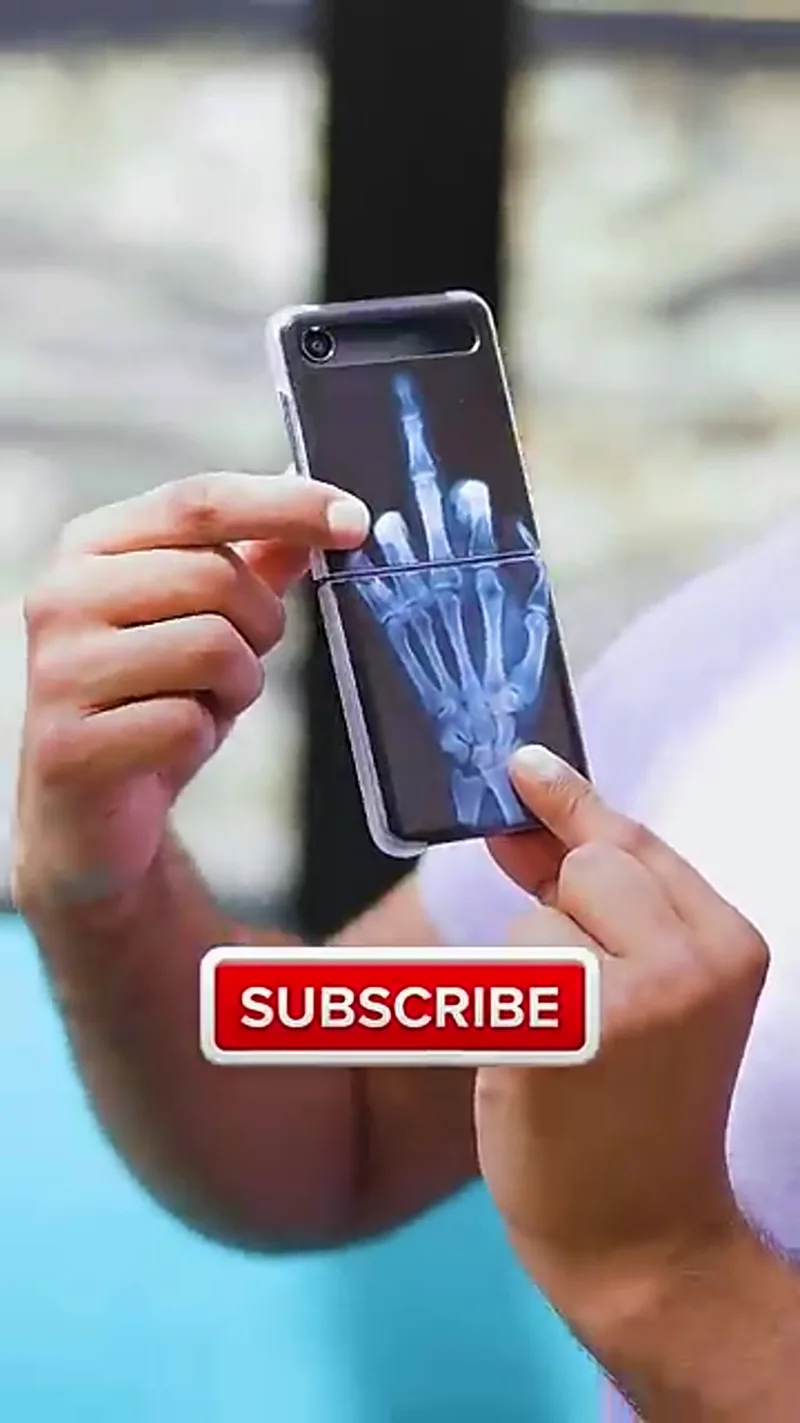 X-ray foldable phone case